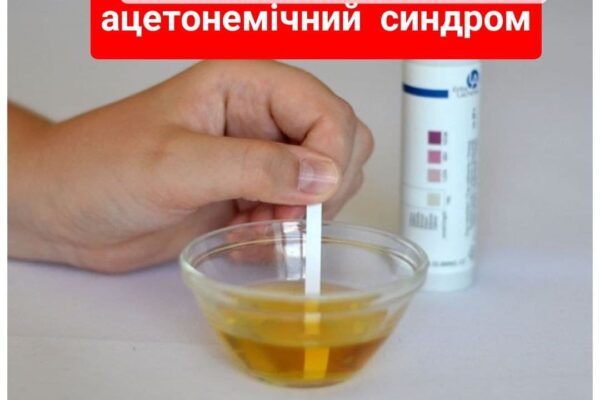 Ацетонемічний синдром